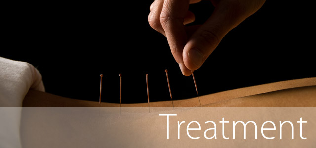 What is Acupuncture
